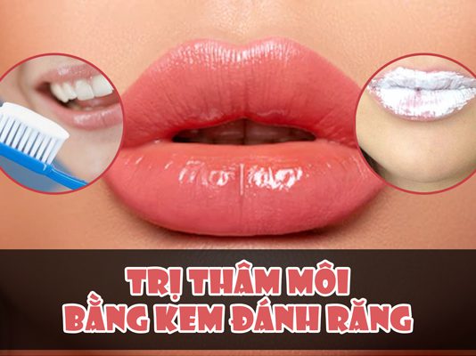 Cách trị thâm môi bằng kem đánh răng hiệu quả