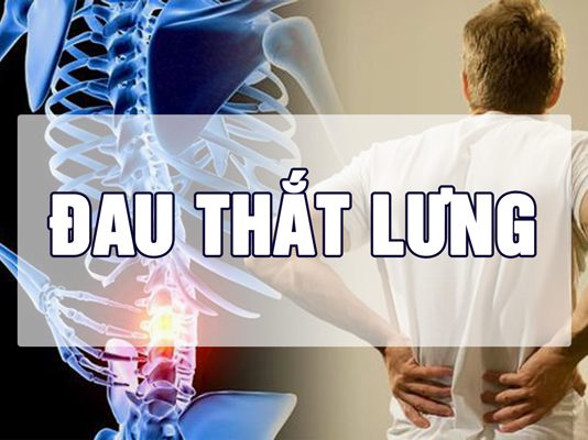 Đau thắt lưng