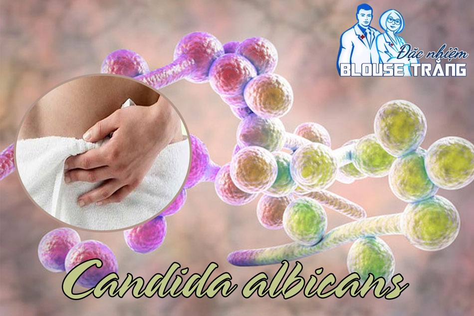 Một trong những thủ phạm gây ra tình trạng khí hư màu trắng đục như bã đậu chính là nấm Candida albicans